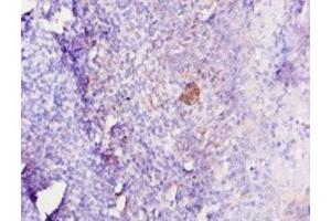 Immunohistochemistry of paraffin-embedded human tonsil tissue using ABIN7179323 at dilution of 1:10