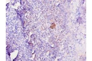 Immunohistochemistry of paraffin-embedded human tonsil tissue using ABIN7179323 at dilution of 1:10 (IL12B anticorps  (AA 23-327))