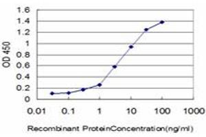 Detection limit for recombinant GST tagged KIAA2002 is approximately 0. (PEAK1 anticorps  (AA 1151-1250))