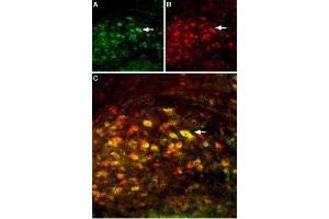 Multiplex staining of GluN2A and GluN2B in mouse deep cerebellar nucleus - Immunohistochemical staining of perfusion-fixed frozen mouse brain sections using Anti-NMDAR2B (GluN2B) (extracellular)-ATTO Fluor-594 Antibody (ABIN7043231), (1:60) and Anti-NMDAR2A (GluN2A) (extracellular) Antibody (ABIN7043228, ABIN7044324 and ABIN7044325), (1:200).
