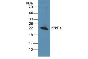 Western blot analysis of recombinant Human REV1. (REV1 anticorps  (AA 301-478))
