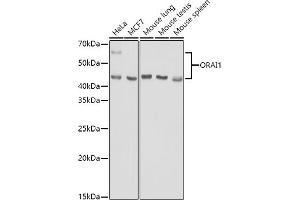 Western blot analysis of extracts of various cell lines, using (ABIN6130598, ABIN6145053, ABIN6145055 and ABIN6223281) at 1:1000 dilution.