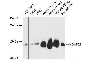 Western blot analysis of extracts of various cell lines using NDUFB2 Polyclonal Antibody at dilution of 1:3000. (NDUFB2 anticorps)