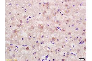 Formalin-fixed and paraffin embedded rat brain labeled with Rabbit Anti CD56/NCAM1 Polyclonal Antibody, Unconjugated (ABIN728398) at 1:200 followed by conjugation to the secondary antibody and DAB staining