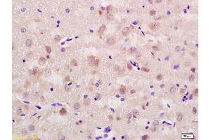 Formalin-fixed and paraffin embedded rat brain labeled with Rabbit Anti CD56/NCAM1 Polyclonal Antibody, Unconjugated (ABIN728398) at 1:200 followed by conjugation to the secondary antibody and DAB staining (CD56 anticorps  (AA 621-720))