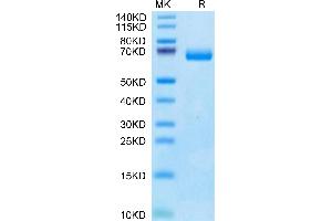 Human IL-2 R beta on Tris-Bis PAGE under reduced condition. (IL2 Receptor beta Protein (AA 27-239) (Fc Tag))