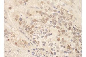 Immunohistochemistry (IHC) image for anti-Zinc Finger E-Box Binding Homeobox 2 (ZEB2) (AA 750-800) antibody (ABIN7448878)