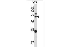 Western blot analysis of ARPC1A antibody in Y79 cell line lysates (35ug/lane) (ARPC1A anticorps  (AA 157-184))