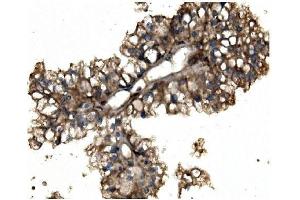 IHC analysis of Aconitase 1/ACO1 using anti-Aconitase 1/ACO1 antibody (ABIN7598988). (Aconitase 1 anticorps  (AA 1-137))