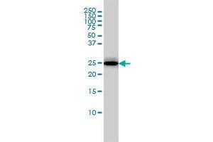 RGS2 monoclonal antibody (M01), clone 4C4 Western Blot analysis of RGS2 expression in MCF-7 . (RGS2 anticorps  (AA 111-211))