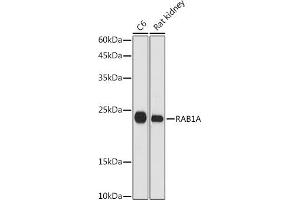 Western blot analysis of extracts of various cell lines, using RA antibody (ABIN7269798) at 1:1000 dilution. (RAB1A anticorps  (AA 1-205))