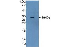 Detection of Recombinant vWA2, Human using Polyclonal Antibody to Von Willebrand Factor A Domain Containing Protein 2 (vWA2)
