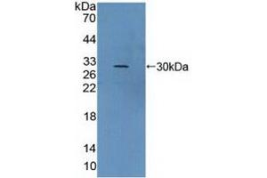 Detection of Recombinant vWA2, Human using Polyclonal Antibody to Von Willebrand Factor A Domain Containing Protein 2 (vWA2) (VWA2 anticorps  (AA 457-708))