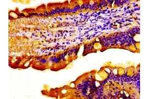Immunohistochemistry of paraffin-embedded human small intestine tissue using ABIN7175433 at dilution of 1:100 (ACADVL anticorps  (AA 403-497))