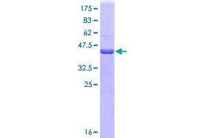 Image no. 1 for Sirtuin 1 (SIRT1) (AA 456-555) protein (GST tag) (ABIN1320039)