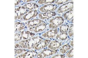 Immunohistochemistry of paraffin-embedded rat stomach using USP5 Rabbit pAb (ABIN1683231, ABIN3018687, ABIN3018688 and ABIN6220542) at dilution of 1:100 (40x lens). (USP5 anticorps  (AA 1-280))