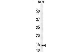 CRCT1 Antibody (N-term) western blot analysis in CEM cell line lysates (35µg/lane). (CRCT1 anticorps  (N-Term))