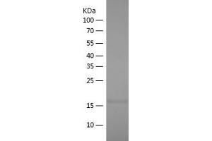 Western Blotting (WB) image for Interleukin 1 Family Member 9 (IL1F9) (AA 13-164) protein (His tag) (ABIN7123519)