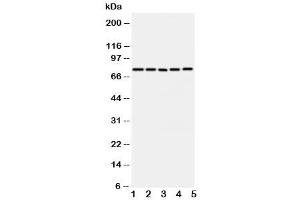Western blot testing of ABCG1 antibody and Lane 1:  U87 (ABCG1 anticorps  (C-Term))