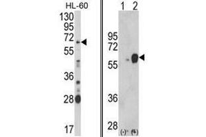 (LEFT) Western blot analysis of ARSB Antibody (Center) in HL-60 cell line lysates (35ug/lane). (Arylsulfatase B anticorps  (Middle Region))