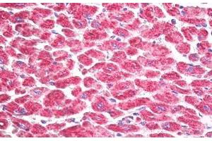 Anti-RPS6KA5 / MSK1 antibody IHC staining of human heart.