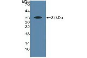 Detection of Recombinant ALOX5, Human using Polyclonal Antibody to 5-Lipoxygenase (5-LO) (ALOX5 anticorps  (AA 461-671))