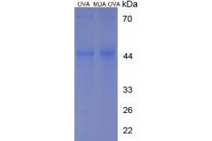 Image no. 2 for Malondialdehyde (MDA) protein (Ovalbumin) (ABIN1880287) (Malondialdehyde Protein (MDA) (Ovalbumin))