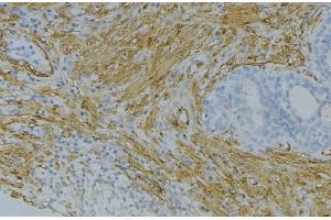 ABIN6274666 at 1/100 staining Human uterus tissue by IHC-P. (FGF18 anticorps  (Internal Region))