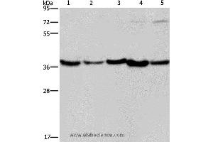 Western blot analysis of Human fetal liver, mouse skeletal muscle and heart tissue, Hela and Jurkat cell, using DNAJB4 Polyclonal Antibody at dilution of 1:200 (DNAJB4 anticorps)