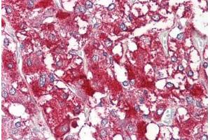 Anti-MYCBP antibody IHC staining of human adrenal. (MYCBP anticorps  (C-Term))