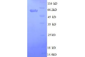 Secreted Protein, Acidic, Cysteine-Rich (Osteonectin) (SPARC) (AA 18-303), (full length) protein (GST tag)