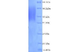 SDS-PAGE (SDS) image for Natriuretic Peptide Receptor A/guanylate Cyclase A (Atrionatriuretic Peptide Receptor A) (NPR1) (AA 33-473), (Extracellular) protein (His tag) (ABIN5713708)