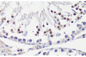 Immunohistochemistry of paraffin-embedded Rat testis using HFM1 Polyclonal Antibody at dilution of 1:100 (40x lens). (HFM1 anticorps)