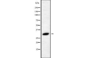 Western blot analysis of RAB40C using HeLa whole cell lysates (RAB40C anticorps)