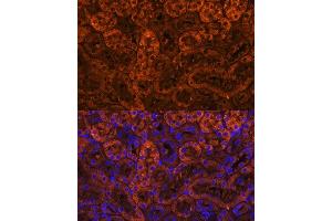 Immunofluorescence analysis of mouse kidney using L Polyclonal Antibody (ABIN6128174, ABIN6143076, ABIN6143077 and ABIN6219002) at dilution of 1:100 (40x lens). (LAMC2 anticorps  (AA 862-1111))