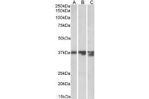 ABIN570917 (0. (Liver Arginase anticorps  (C-Term))