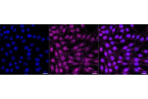 Immunocytochemical staining of C2C12 cells with Phospho-AKT1 (S129) antibody (ABIN7800785), 1:1,000).