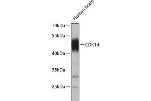 Western blot analysis of extracts of human brain, using CDK14 antibody (ABIN1681332, ABIN3017688, ABIN3017689 and ABIN5664288).