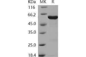 Western Blotting (WB) image for Galactokinase 1 (GALK1) protein (GST tag,His tag) (ABIN7195881)