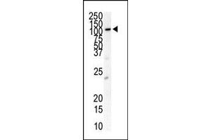 Western blot analysis of anti-FLT3 Pab (ABIN391981 and ABIN2841772) in HL-60 cell lysate.