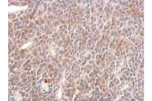 IHC-P Image SHP2 antibody detects PTPN11 protein at cytosol on BT483 xenograft by immunohistochemical analysis.
