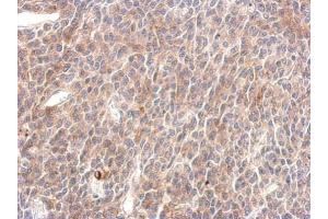 IHC-P Image SHP2 antibody detects PTPN11 protein at cytosol on BT483 xenograft by immunohistochemical analysis. (PTPN11 anticorps  (C-Term))