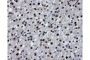 Image no. 18 for anti-Replication Protein A2, 32kDa (RPA2) antibody (ABIN1500733)