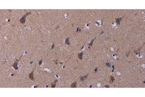 Immunohistochemistry of paraffin-embedded Human brain tissue using TUBGCP2 Polyclonal Antibody at dilution 1:50