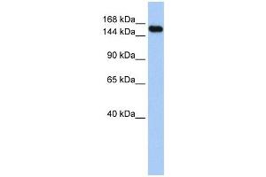 UBE3A antibody used at 1 ug/ml to detect target protein. (ube3a anticorps  (Middle Region))