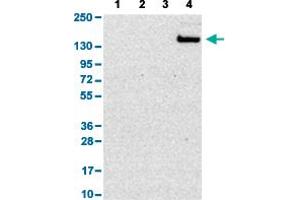 Western Blot analysis with SIGLEC1 polyclonal antibody . (Sialoadhesin/CD169 anticorps  (AA 1425-1510))