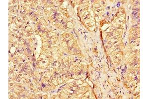 Immunohistochemistry of paraffin-embedded human adrenal gland tissue using ABIN7158780 at dilution of 1:100 (CTSA anticorps  (AA 30-327))