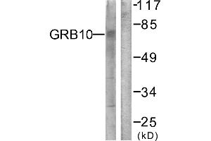 Immunohistochemistry analysis of paraffin-embedded human brain tissue using GRB10 (Ab-67) antibody. (GRB10 anticorps)