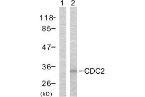 Western blot analysis of the extracts from COLO cells using CDC2 (Ab-161) antibody (E021152). (CDK1 anticorps)