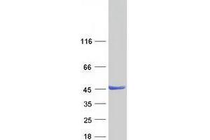Zinc Binding Alcohol Dehydrogenase Domain Containing 2 (ZADH2) protein (Myc-DYKDDDDK Tag)